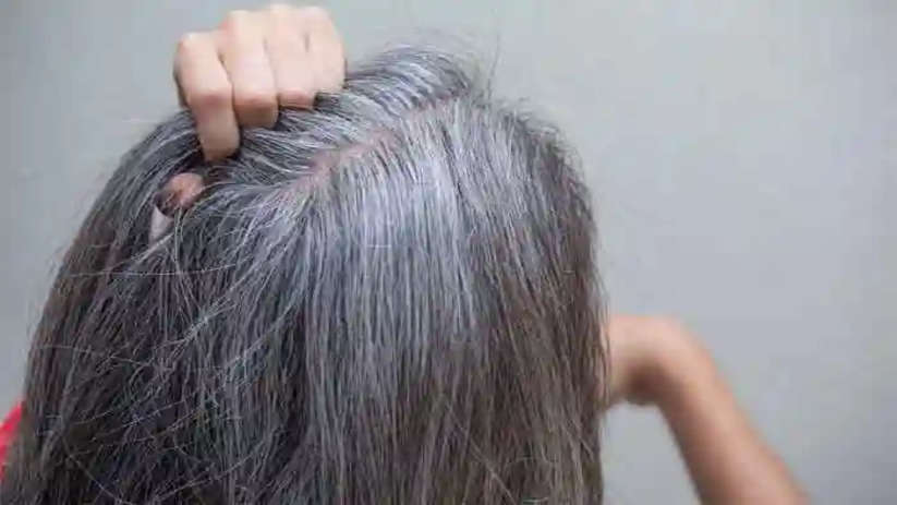 Quick Solutions To Reverse Your Premature Grey Hair, Kochi, News, Top Headlines, Solutions, Grey Hair, Health Tips, Health, Warning, Kerala News